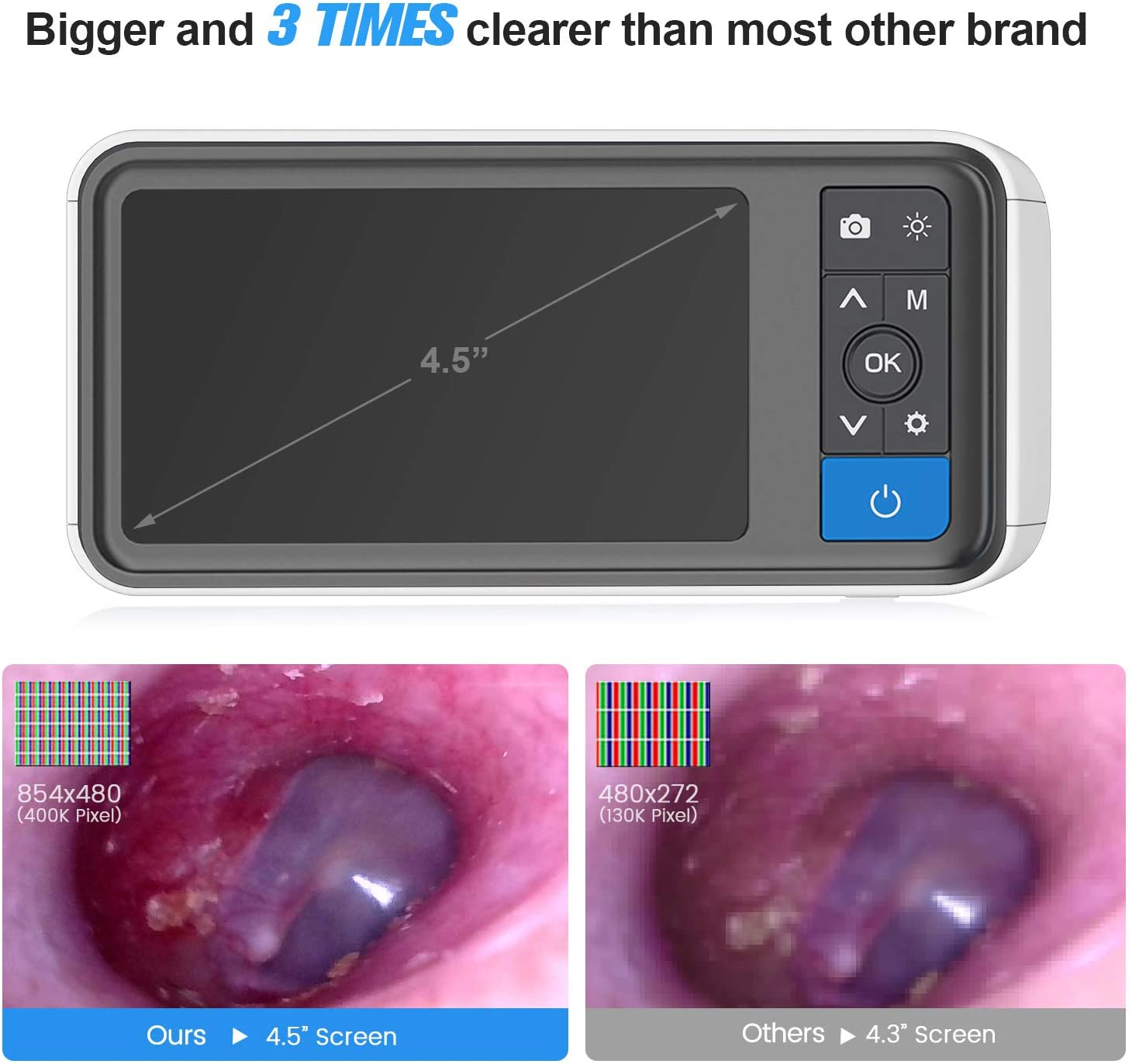 Digital Otoscope with 4.5 Inches Screen