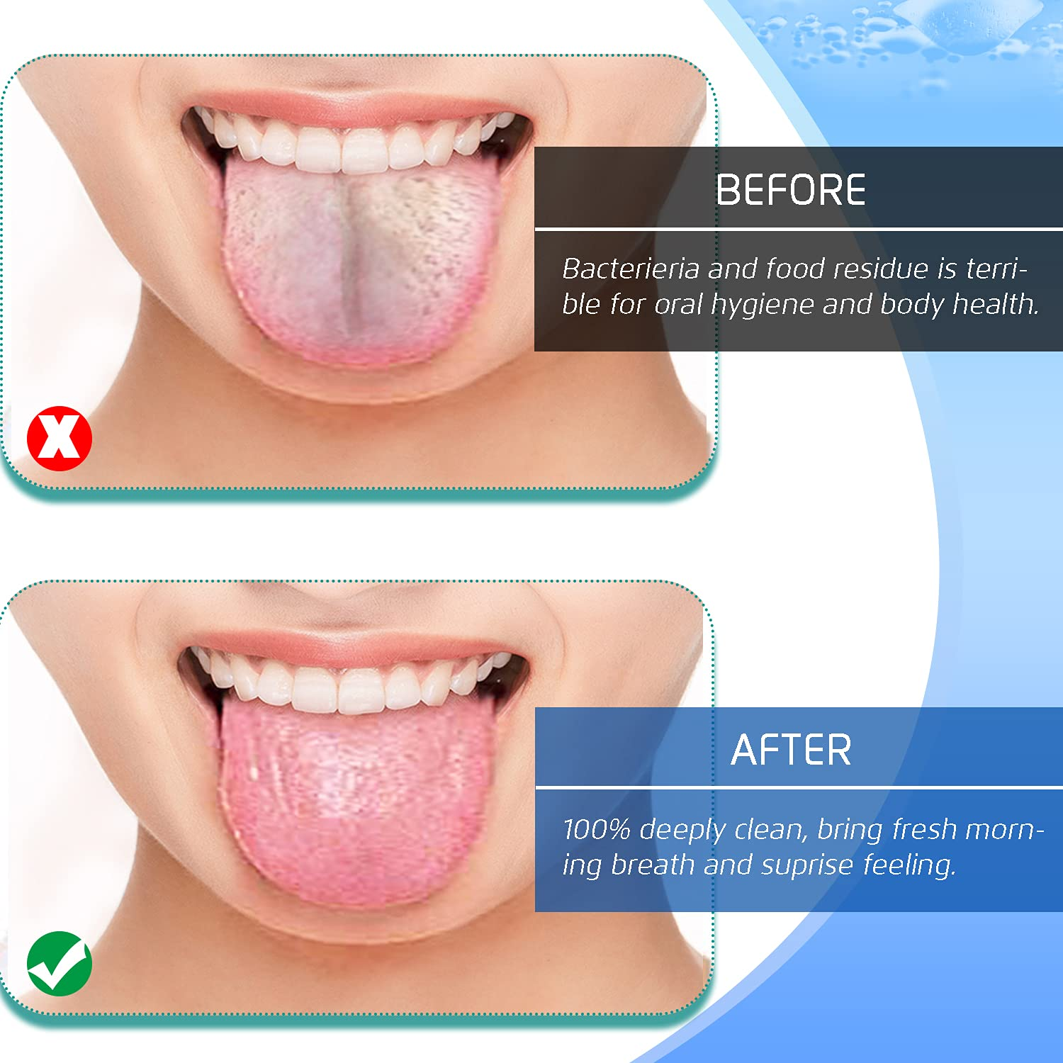 Stainless Steel Tongue Cleaners