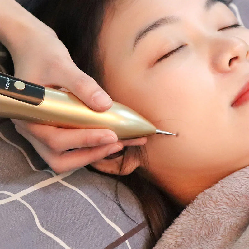 Freckle Removal Laser Plasma Pen with LCD Digital Display- USB Charging_11